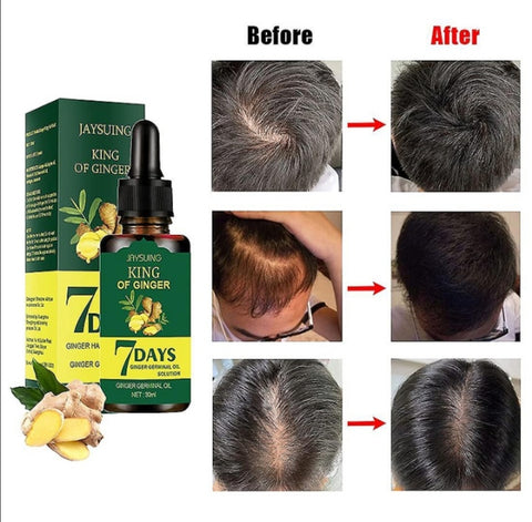 Ulje za kosu serum na bazi djumbira 30ml za rast kose
